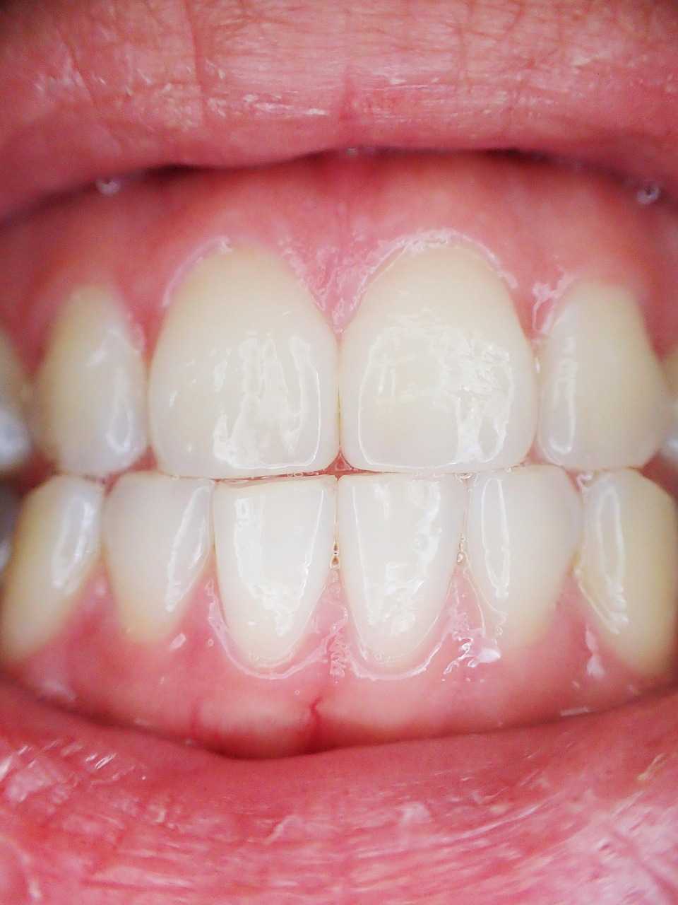 Close-up of a healthy, bright smile showcasing cosmetic and restorative dental results, representing Dental Funding Specialists, Dental Financing Programs, Dental Practice Acquisition Funding, Dental Marketing Financing, and Dental Commercial Mortgage solutions for dental practice growth and expansion.