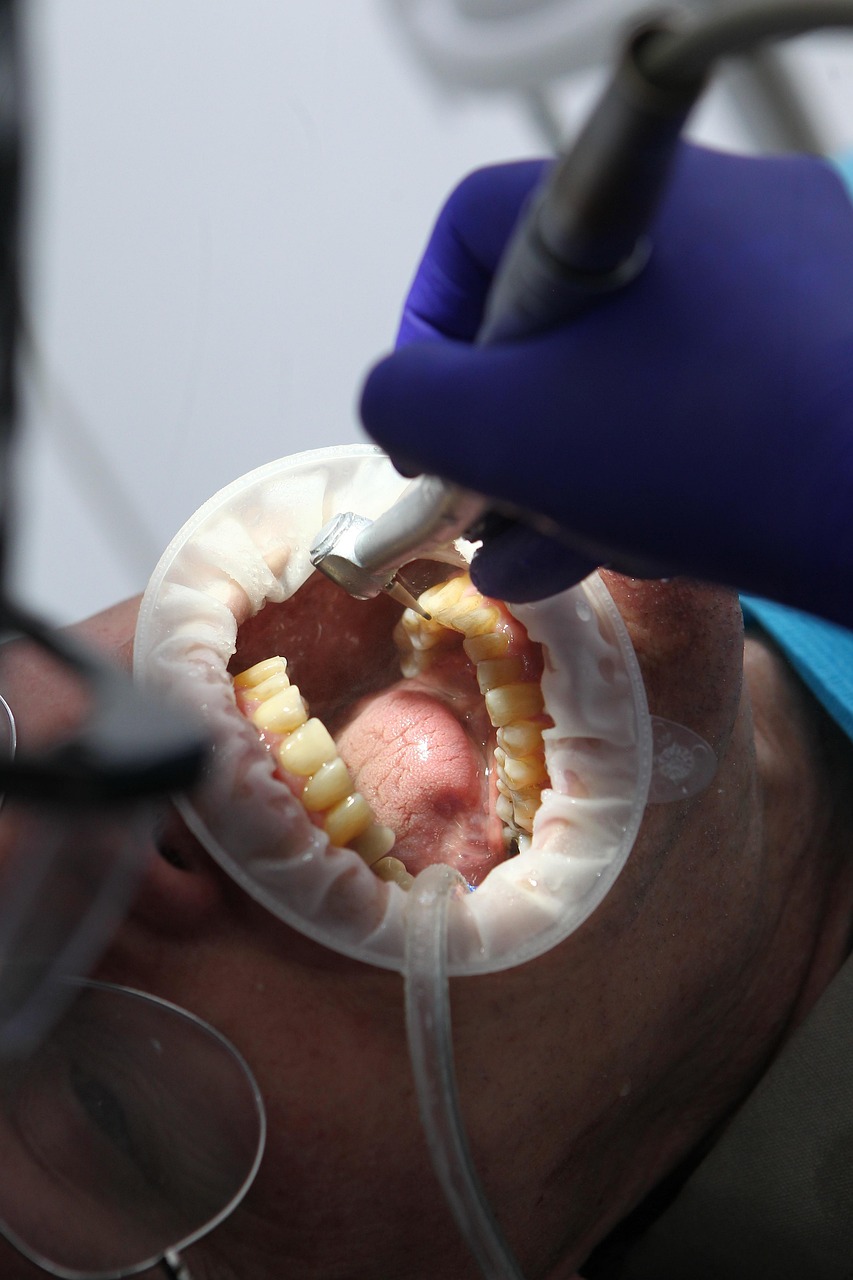 Dental professional performing a restorative procedure using advanced digital equipment in a modern practice, representing Dental Office Property Funding, Dental Payroll Financing, Dental Scheduling Software Financing, Digital Workflow Financing, and Dental Working Capital Loans for growing dental offices.