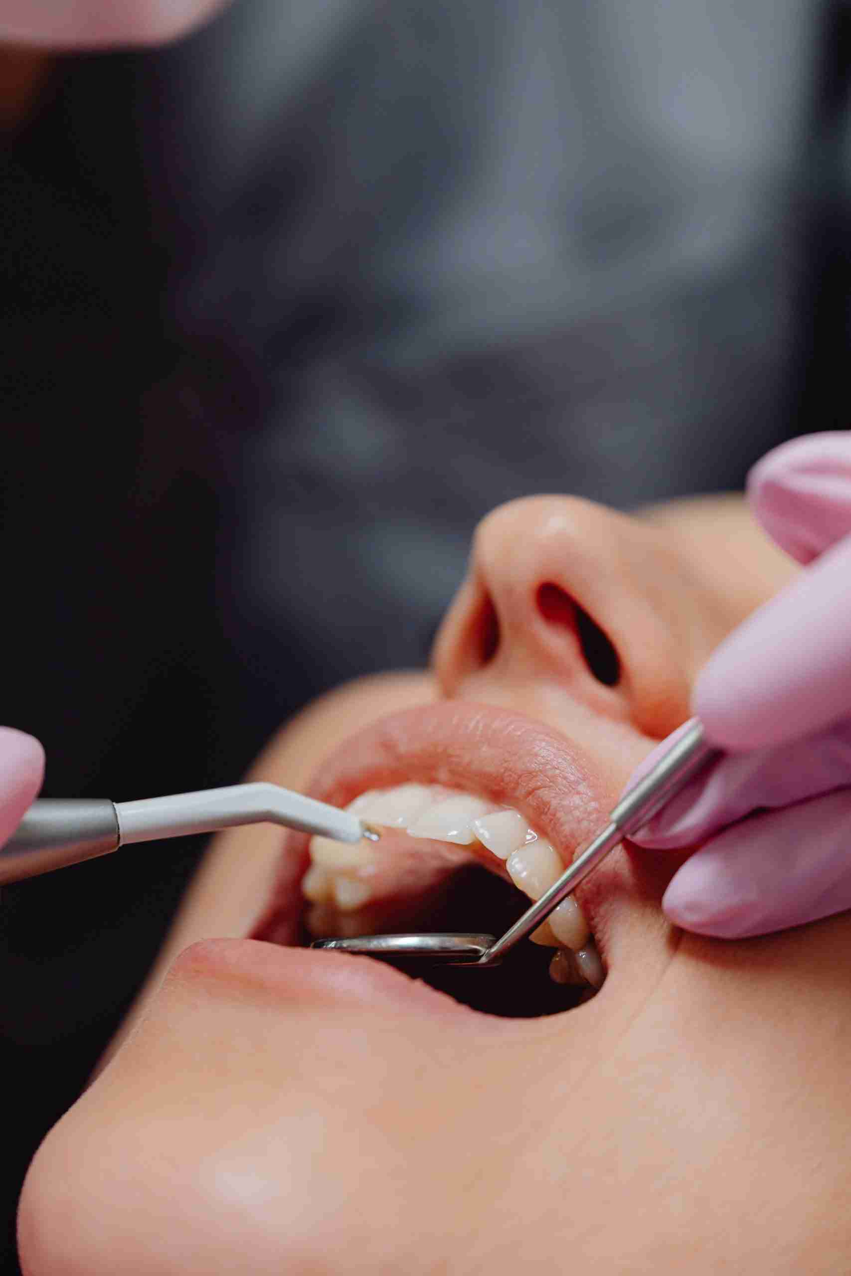 Close-up of a dental examination using advanced instruments and modern technology, highlighting Dental Growth Capital, Digital Dentistry Financing, Dental Office Acquisition Loans, Dental Sterilization Equipment Financing, and Dental Business Startup Loans for practice development and patient care improvements.
